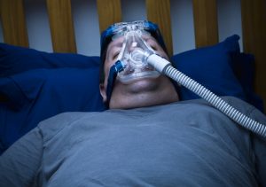 overweight man with sleep apnea mask